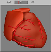 Standardansichten des Herzens (RAO/LAO)